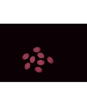ASARI SOFT LUMINOUS OVAL BEADS PINK